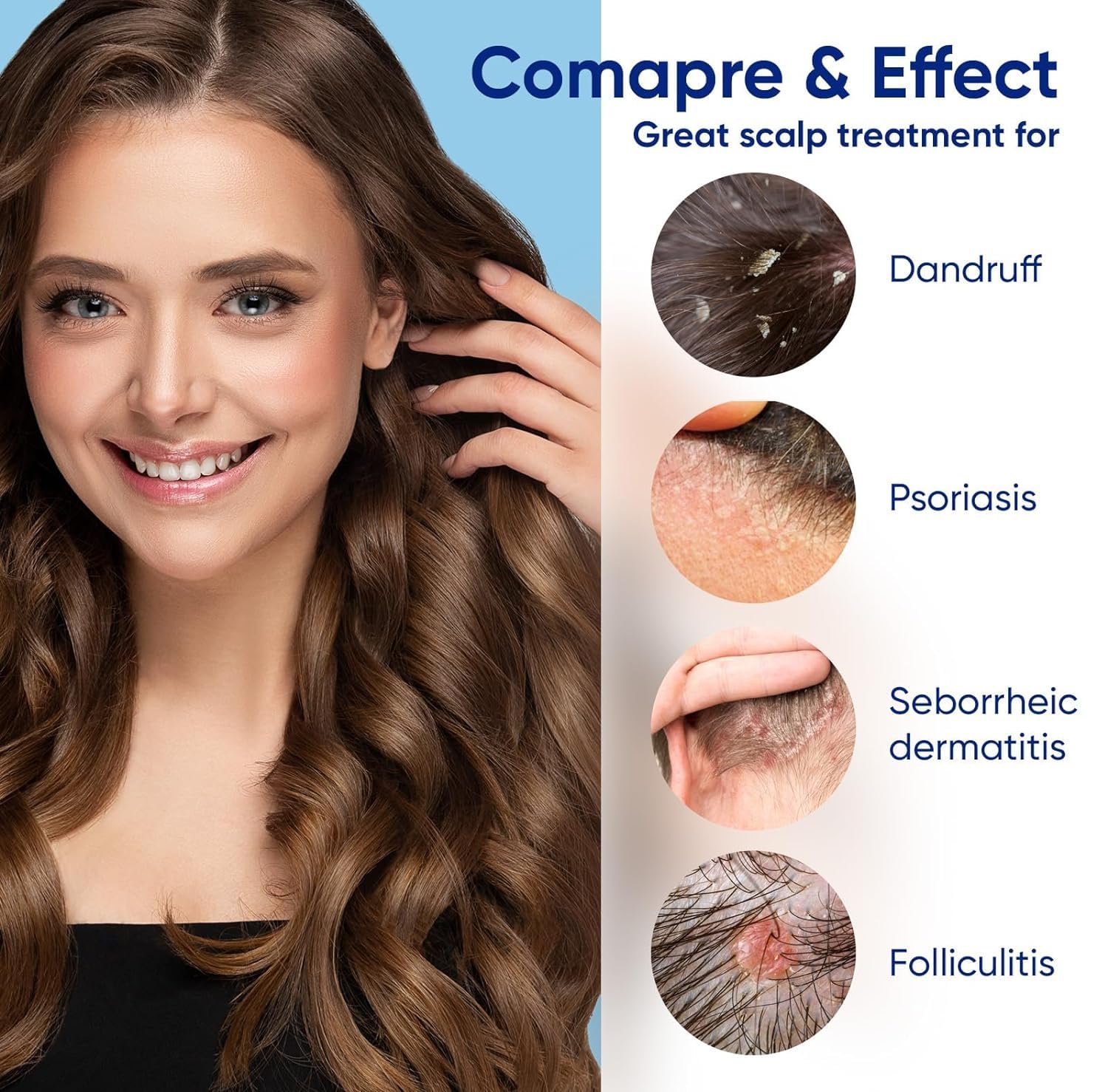 Medicated Shampoo For Seborrheic Dermatitis: Anti-Dandruff Treatment for Itchy Scalp, Dermatitis, Anti-Fungal Care for Men & Women, Controls Oil, Flaking & Scalp Irritation - Image 6