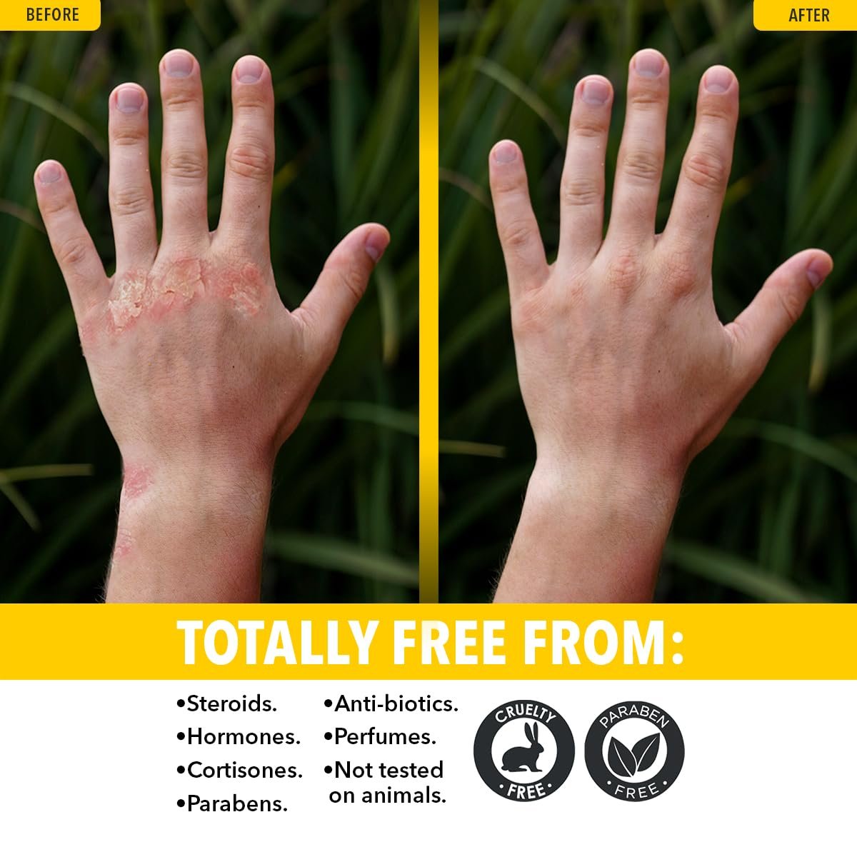 Dr. Robaina Sulfur Balsam Cleansing Bar – Daily Soap for Acne and Eczema Relief – Gentle on Sensitive Skin with Tea Tree and Calendula – Made in the USA (Pack of 1) - Image 7