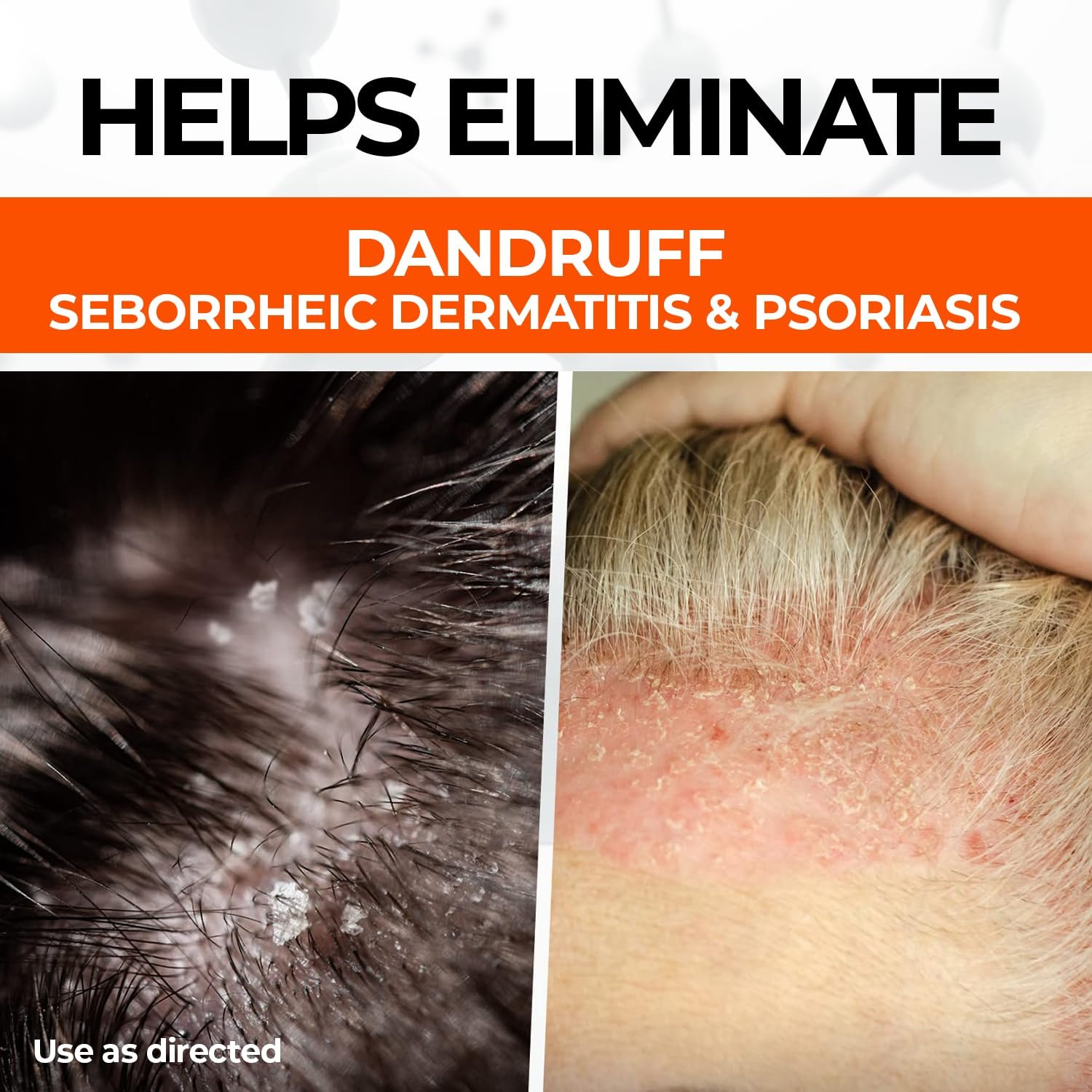 Medicasp Coal Tar Anti-Dandruff Shampoo, Alleviates Symptoms from 1st Wash, Treats Psoriasis, Seborrheic Dermatitis & Itchy Dry Scalp, Fights the Root Cause of Dandruff, Flakes Shampoo, 6 fl oz - Image 4