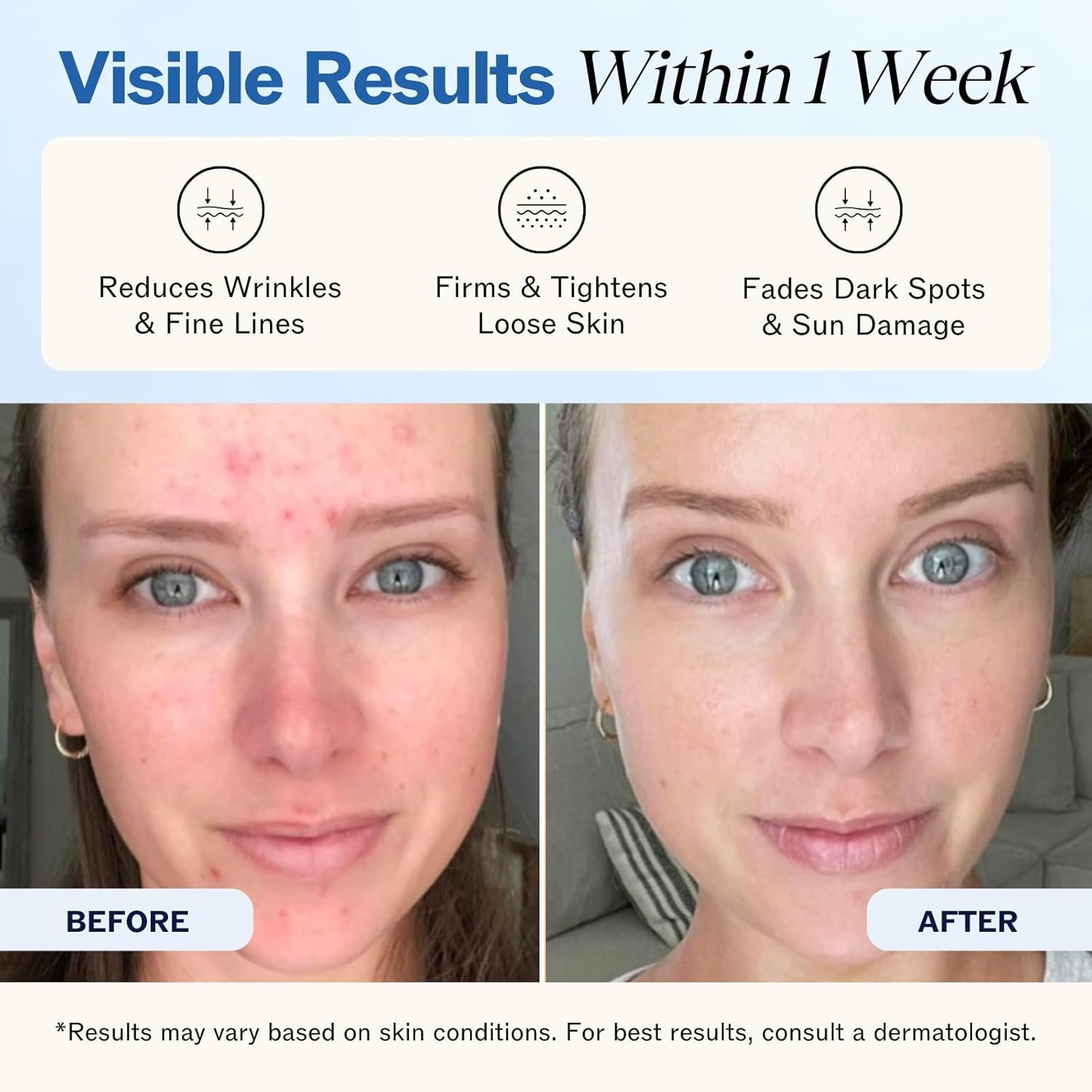 LilyAna Naturals Anti Aging Retinol Face Cream for Women – Wrinkle & Neck Cream for Firming, Retinol Moisturizer for Face with Hyaluronic Acid, Hydrating Night Cream for Fine Lines, Collagen Boost - Image 3