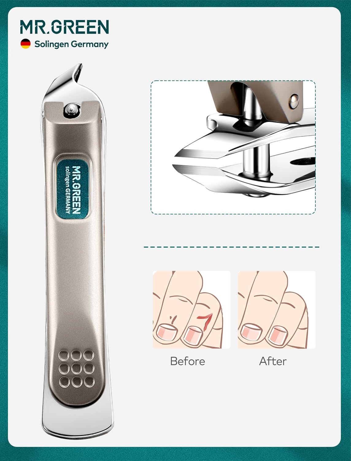 Manicure Set, Pedicure Sets, Nail Clipper Sets, Stainless Steel Professional Nail Cutter Kits with Travel Case (12 Count) - Image 6