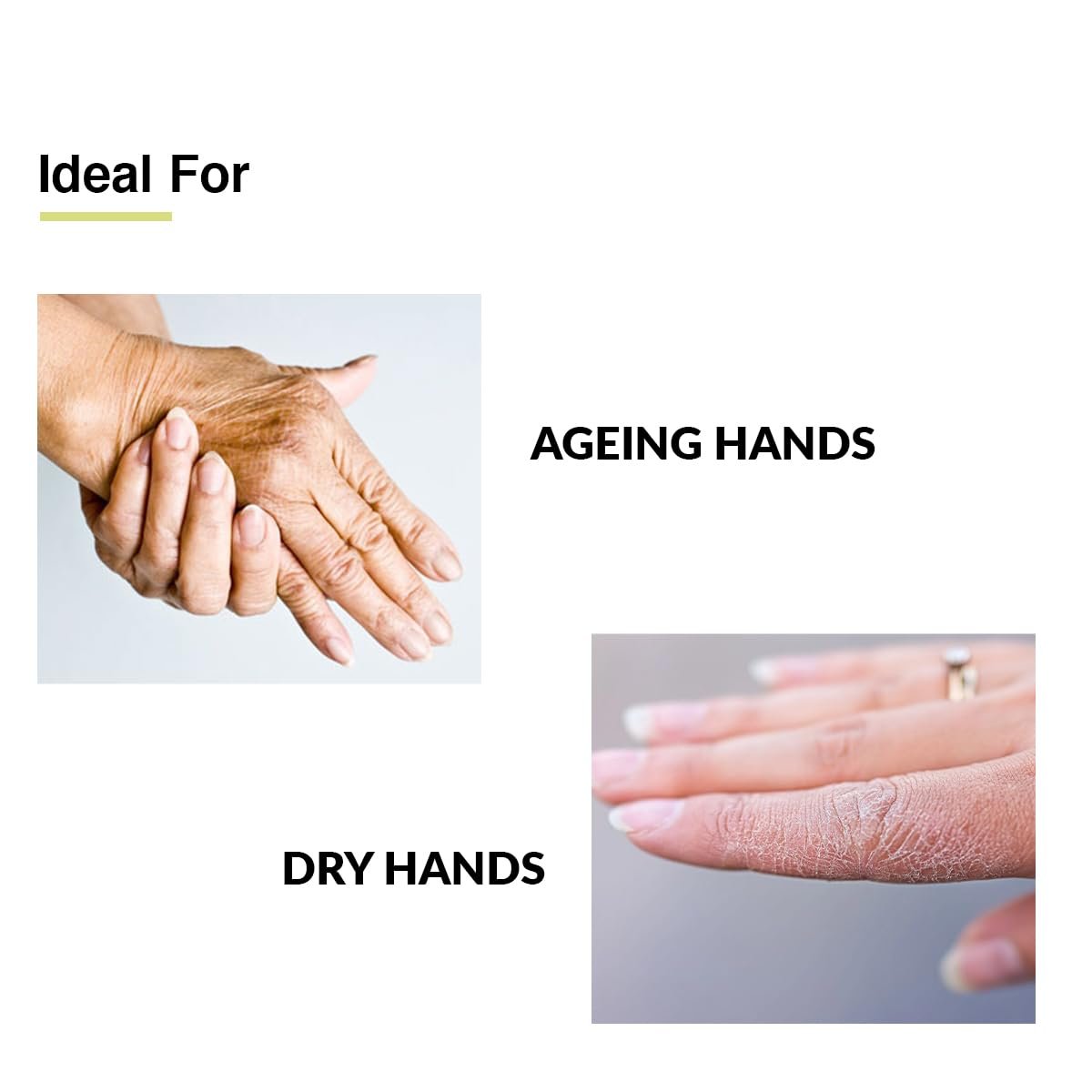 FIXDERMA Anti Ageing Hand Cream for Women & Men | Ceramide Moisturizer | Hyaluronic Acid Cream | Hand Cream for Dry and Rough Hands | Shea Butter | Cream for Itchy Hand | All Skins Types - 30g - Image 5