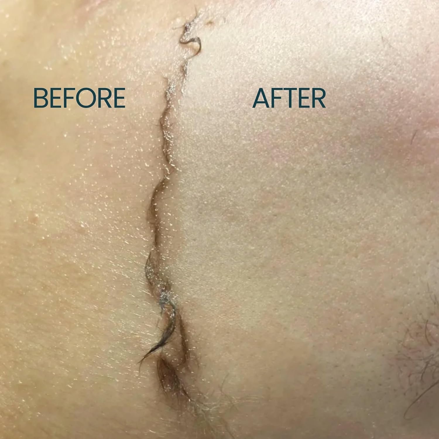 Dermaplane Oil for Women with Sensitive Skin - Face Shaving Oil - Non Comedogenic, Fragrance Free, Natural & Lightweight - Use with Dermaplane Razor for Women Face, 2oz by Ouiloe - Image 5