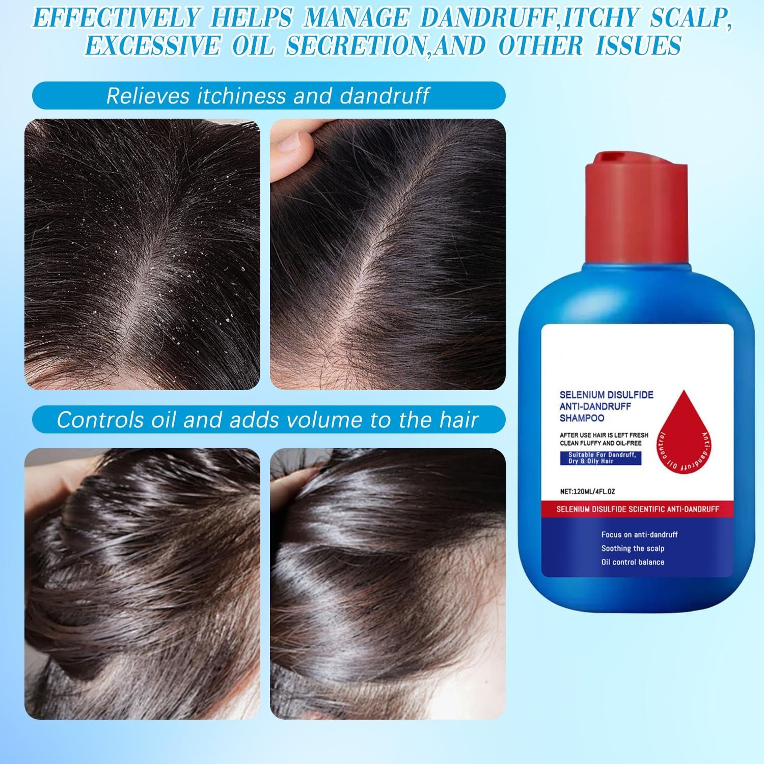 Nippori Anti-Dandruff Shampoo, Oil Control Formula for Men and Women, 300ml - Image 5