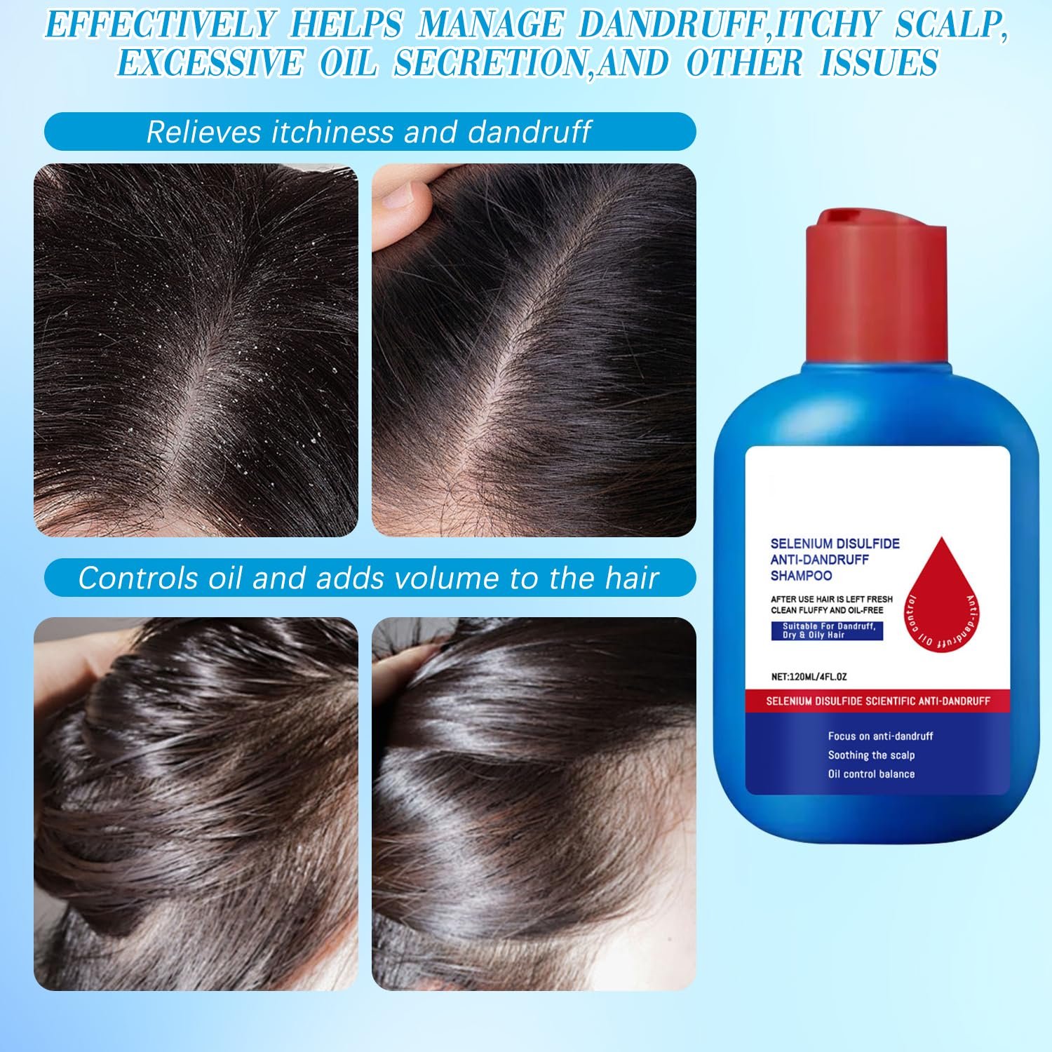 Nipori Shampoo,Nipori Oil Control Refreshing Anti-Dandruff Cleansing Shampoo,Anti Hair Loss for Men and Women - Image 6