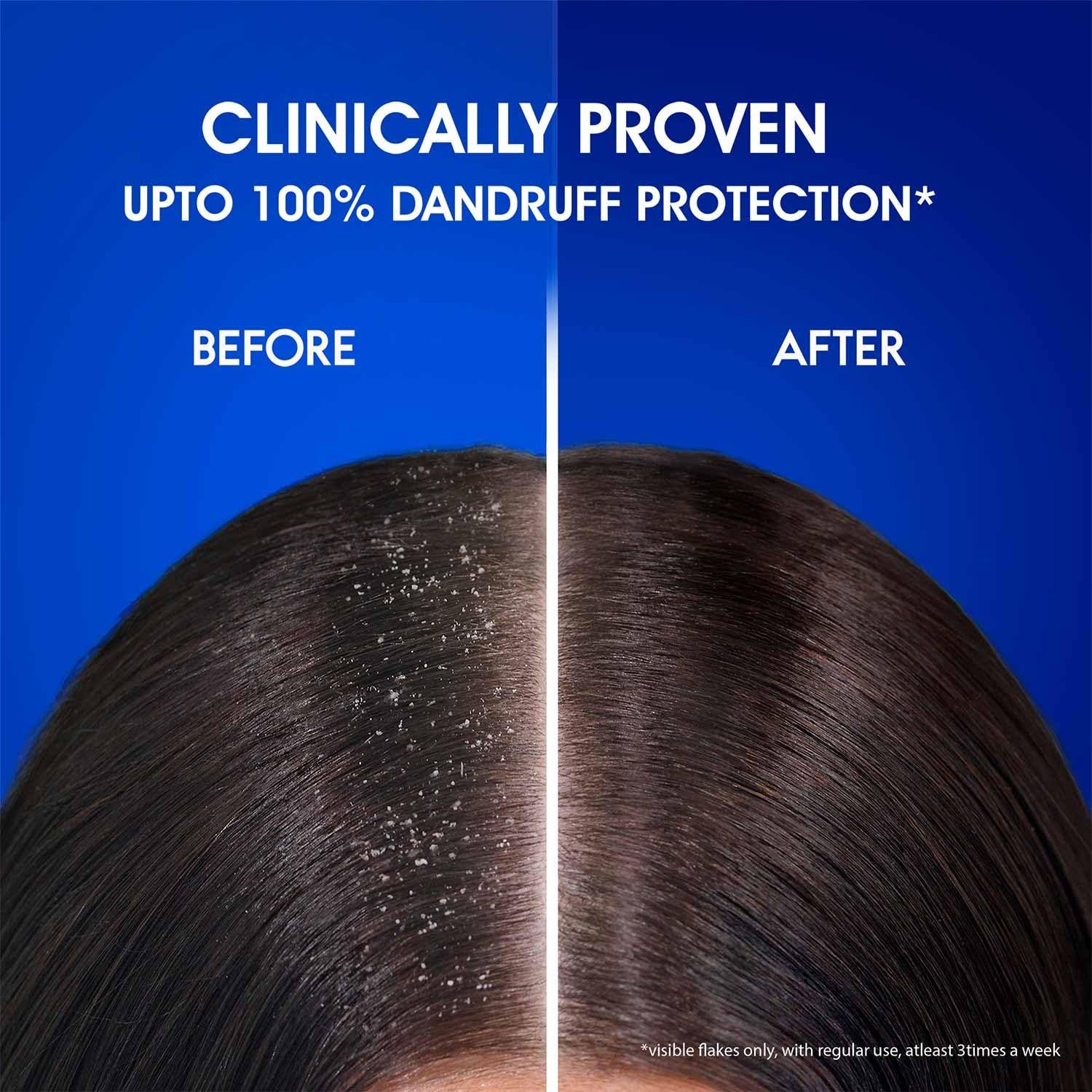 Head & Shoulders Anti Dandruff Cool Menthol Shampoo, 340ml - Image 11