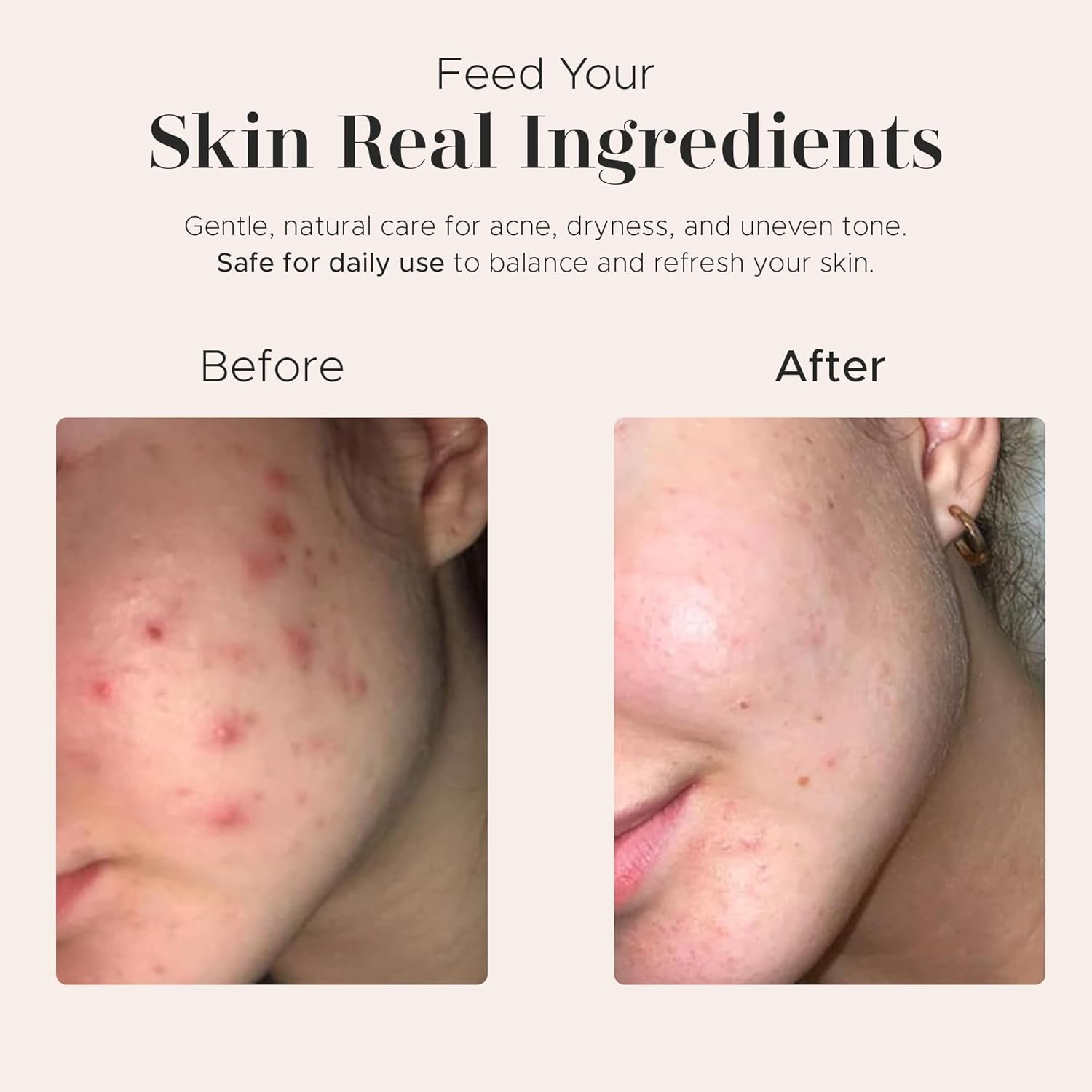 era of nature Best Raw ORGANIC AFRICAN BLACK SOAP, for Dry Skin and Skin Conditions. Pure & Natural Ingredients, Imported From Ghana - 1lb (16oz) - Image 7