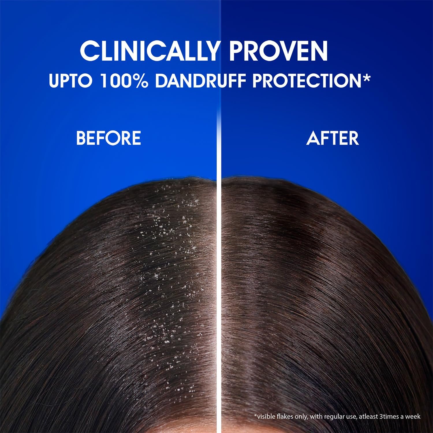 Head & Shoulders Anti Dandruff Cool Menthol Shampoo, 340ml - Image 9