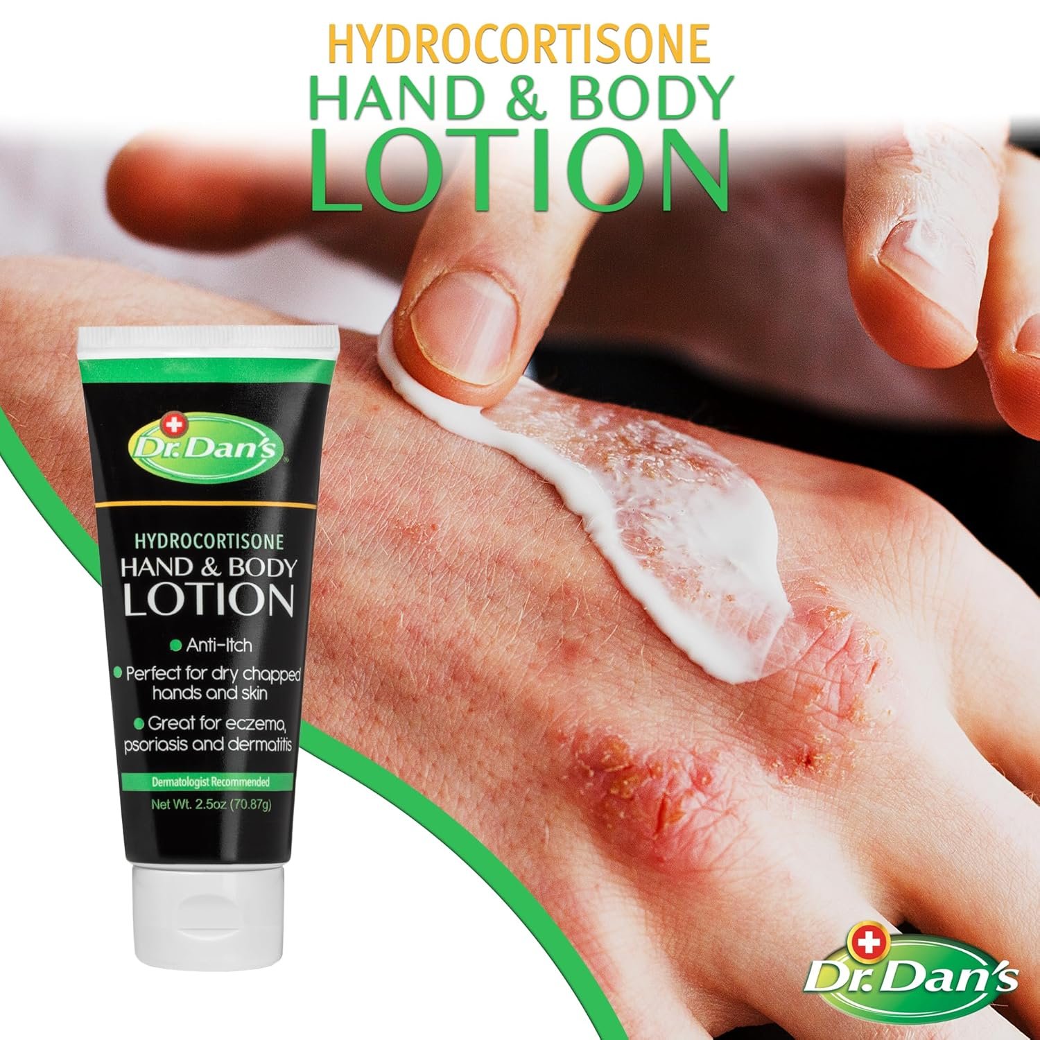 Dr. Dan's Hydrocortisone Hand and Body Lotion - Anti Itch Lotion for Men and Women - 1 Pack - Image 5